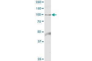 Immunoprecipitation of HELLS transfected lysate using anti-HELLS MaxPab rabbit polyclonal antibody and Protein A Magnetic Bead , and immunoblotted with HELLS purified MaxPab mouse polyclonal antibody (B01P) . (HELLS 抗体  (AA 1-838))