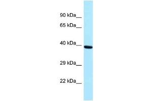 Western Blotting (WB) image for anti-PRP18 Pre-mRNA Processing Factor 18 (PRPF18) (Middle Region) antibody (ABIN2774355)