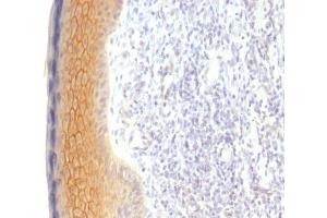 Formalin-fixed, paraffin-embedded human Skin stained with Catenin, gamma Monoclonal Antibody (CTNG/1483) (JUP 抗体)