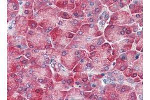 Immunohistochemistry (Paraffin-embedded Sections) (IHC (p)) image for anti-Toll-Like Receptor 3 (TLR3) (C-Term) antibody (ABIN615251)