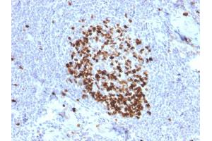 Formalin-fixed, paraffin-embedded human Tonsil stained with Ki67 Mouse Monoclonal Antibody (MKI67/2466). (Ki-67 抗体  (AA 2293-2478))