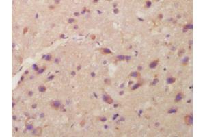 Formalin-fixed and paraffin embedded rat brain labeled with Anti-ITM2A Polyclonal Antibody, Unconjugated  at 1:200 followed by conjugation to the secondary antibody and DAB staining (ITM2A 抗体  (AA 73-123))