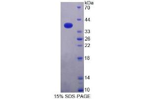 SDS-PAGE analysis of Human NAPa Protein. (NAPA 蛋白)