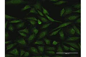 Immunofluorescence of purified MaxPab antibody to RIPK2 on HeLa cell. (RIPK2 抗体  (AA 1-540))