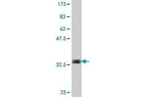 Western Blotting (WB) image for anti-Collagen, Type XIV, alpha 1 (COL14A1) (AA 34-120) antibody (ABIN563344)