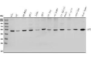 Western blot analysis of Sp7/Osterix using anti-Sp7/Osterix antibody (ABIN7600476).