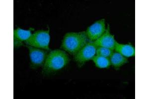 IF analysis of ASS1 using anti-ASS1 antibody (ABIN7601192).