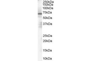 PARP2 抗体  (Internal Region)