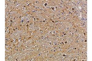 ABIN6265059 and ABIN6279814 at 1/100 staining mouse brain tissue by IHC-P.