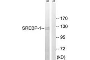Western blot analysis of extracts from Jurkat cells, treated with TNF 20ng/ml 30', using SREBP-1 (Ab-439) Antibody. (SREBF1 抗体  (AA 405-454))