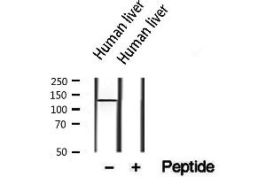 Western blot analysis of extracts from human liver, using PTPRO antibody. (PTPRU 抗体  (Internal Region))