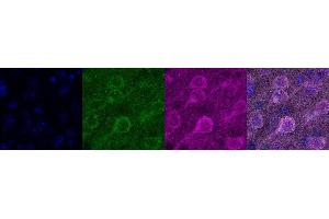 Immunohistochemistry (IHC) image for anti-Calcium/calmodulin-Dependent Protein Kinase II alpha (CAMK2A) antibody (ABIN7456112) (CAMK2A 抗体)