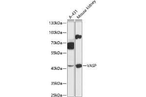 Western blot analysis of extracts of various cell lines, using VASP antibody (ABIN6134453, ABIN6150064, ABIN6150065 and ABIN6218508) at 1:3000 dilution. (VASP 抗体  (AA 1-100))