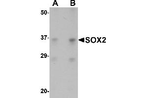Western Blotting (WB) image for anti-SRY (Sex Determining Region Y)-Box 2 (SOX2) (N-Term) antibody (ABIN1031582) (SOX2 抗体  (N-Term))