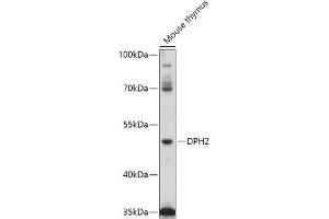 Western blot analysis of extracts of Mouse thymus, using DPH2 antibody (ABIN7266787) at 1:1000 dilution. (DPH2 抗体  (AA 120-330))