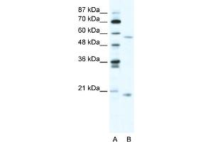 WB Suggested Anti-ZNF18 Antibody Titration:  5ug/ml  Positive Control:  HepG2 cell lysate (ZNF18 抗体  (N-Term))