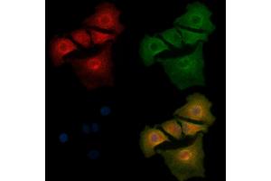 ABIN6261249 and ABIN6268912 staining  cells by IF/ICC. (DDR1 抗体  (C-Term))