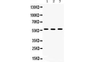 Western blot analysis of TCP1 beta expression in rat testis extract ( Lane 1), mouse spleen extract ( Lane 2) and SW620 whole cell lysates ( Lane 3). (CCT2 抗体  (AA 414-535))