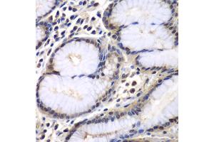 Immunohistochemistry of paraffin-embedded human colon using PSMB2 antibody (ABIN6291444) at dilution of 1:100 (40x lens). (PSMB2 抗体)
