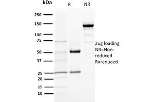 SDS-PAGE Analysis Purified DOG-1 Mouse Monoclonal Antibody (DG1/1484). (ANO1 抗体  (AA 2-101))