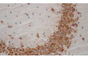 Immunohistochemistry of paraffin-embedded Mouse brain using WNT1 Polyclonal Antibody at dilution of 1:50 (WNT1 抗体)