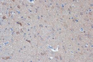 Immunohistochemistry of paraffin-embedded rat brain using Raptor Rabbit mAb (ABIN7269900) at dilution of 1:100 (40x lens). (Raptor 抗体)