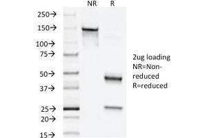 SDS-PAGE (SDS) image for anti-Napsin A Aspartic Peptidase (NAPSA) (AA 189-299) antibody (ABIN6941161)