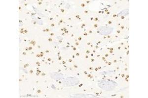 Immunohistochemistry analysis of paraffin-embedded mouse brain using,SETD2 (ABIN7075582) at dilution of 1: 3600 (SETD2 抗体)