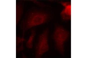 Immunofluorescence (IF) image for anti-Microtubule-Associated Protein tau (MAPT) (pSer404) antibody (ABIN1870403) (MAPT 抗体  (pSer404))
