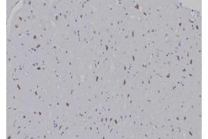 ABIN6277195 at 1/100 staining Human heart tissue by IHC-P. (Histone 3 抗体  (H3K9me))