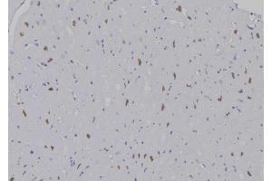 ABIN6277195 at 1/100 staining Human heart tissue by IHC-P.