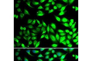 Immunofluorescence analysis of U2OS cells using PDIA6 Polyclonal Antibody (PDIA6 抗体)