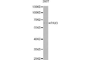 Western blot analysis of extracts of 293T cells, using PAX3 antibody (ABIN6290725) at 1:1000 dilution. (Paired Box 3 抗体)