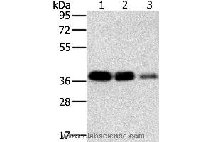 Western blot analysis of A549, HT-29 and A172 cell, using MTFR1 Polyclonal Antibody at dilution of 1:500 (MTFR1 抗体)