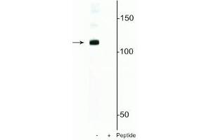 Western blot of mouse nuclei lysate showing specific immunolabeling of the ~120 kDa DGCR8 protein phosphorylated at in the first lane (-). (DGCR8 抗体  (pSer377))