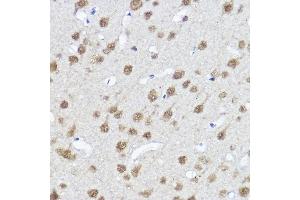 Immunohistochemistry of paraffin-embedded Rat brain using MYOCD antibody (ABIN7268730) at dilution of 1:100 (40x lens). (Myocardin 抗体  (AA 650-750))