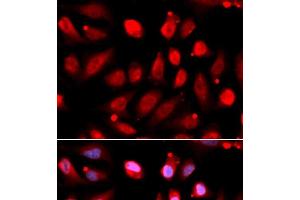 Immunofluorescence analysis of U2OS cells using EZH2 Polyclonal Antibody (EZH2 抗体)