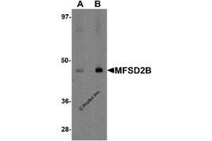 Western Blotting (WB) image for anti-Major Facilitator Superfamily Domain Containing 2B (MFSD2B) (Middle Region) antibody (ABIN1031004) (MFSD2B 抗体  (Middle Region))