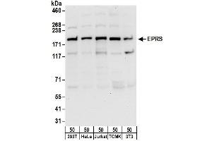 anti-Glutamyl-Prolyl-tRNA Synthetase (EPRS) (AA 950-1000) antibody