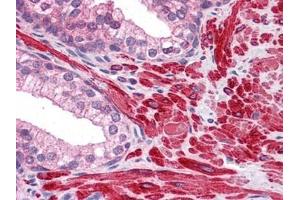 Human Prostate: Formalin-Fixed, Paraffin-Embedded (FFPE) (DPP8 抗体)