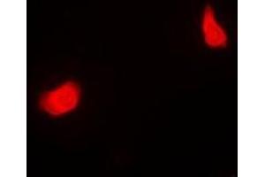 Immunofluorescent analysis of PSMC5 staining in MCF7 cells.
