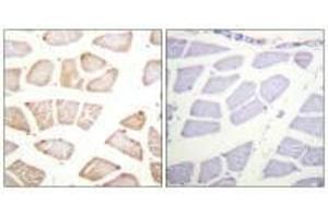 Immunohistochemistry analysis of paraffin-embedded human skeletal muscle tissue using Akt (Ab-129) antibody.