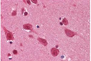 Human Brain, Cortex: Formalin-Fixed, Paraffin-Embedded (FFPE) (TARDBP 抗体  (AA 1-261))