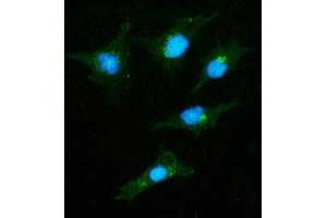 anti-Cytoplasmic Linker Associated Protein 2 (CLASP2) (AA 266-1230) antibody