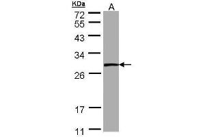 WB Image Sample (30 ug of whole cell lysate) A: A431 12% SDS PAGE antibody diluted at 1:1000 (PSPH 抗体)