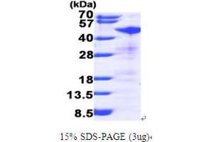 RRM2 Protein (AA 1-389) (His tag)