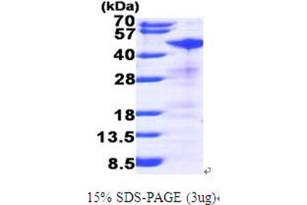 RRM2 Protein (AA 1-389) (His tag)