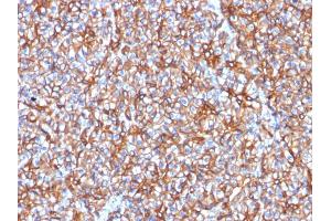 Formalin-fixed, paraffin-embedded human Pancreas stained with Spectrin beta III Mouse Monoclonal Antibody (SPTBN2/1778). (Spectrin, Beta, Non-erythrocytic 2 (SPTBN2) (AA 356-475) 抗体)