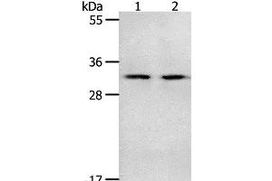 Western Blot analysis of Mouse spleen and intestinum crassum tissue using NME6 Polyclonal Antibody at dilution of 1:400 (NME6 抗体)