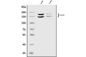 Western blot analysis of Astrin/Deepest/SPAG5 using anti-Astrin/Deepest/SPAG5 antibody (ABIN7602399). (SPAG5 抗体  (AA 738-1193))